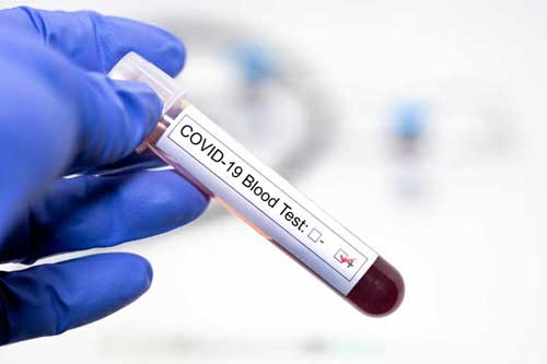 Cuba comenzará a exigir en enero de 2021 una prueba de PCR negativa para Covid-19 a los viajeros provenientes del extranjero, realizada por un laboratorio certificado en el país de origen.