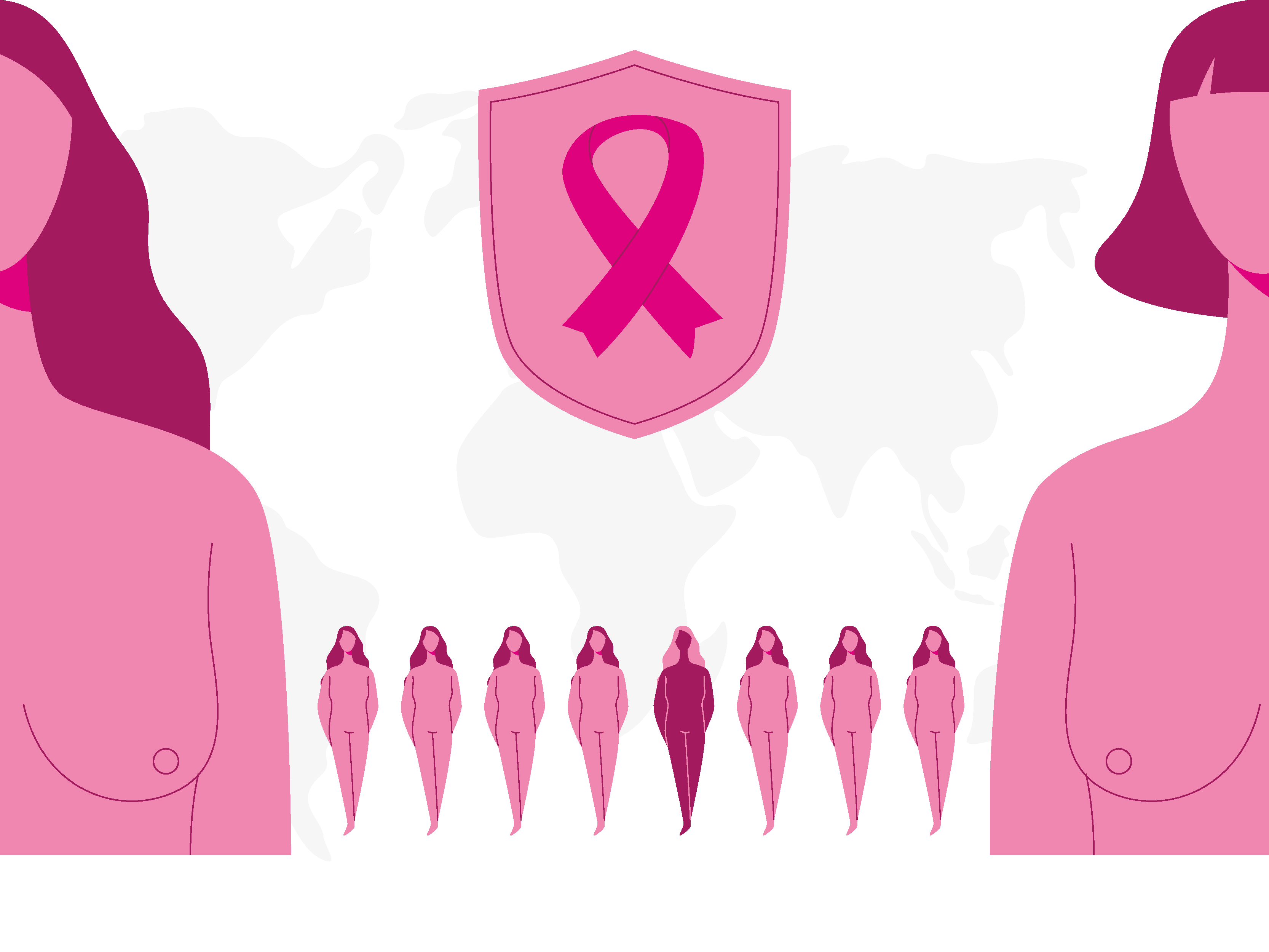 El cáncer de mama es un padecimiento donde las células de la mama se reproducen sin control